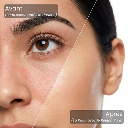 Keejoa Pure™ - Pommeau de douche filtrant premium 3 - en - 1 - Keejoa
